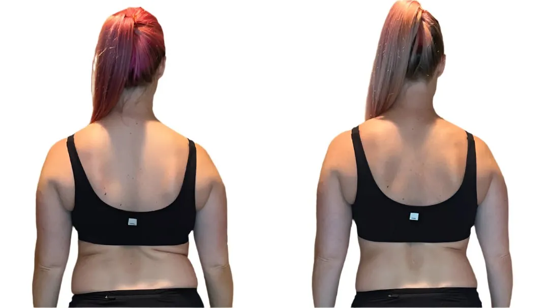 Cryo T-Shock - 5 Treatments in 60 days - Only $1695 (Limited Time Offer) w/Lumens device