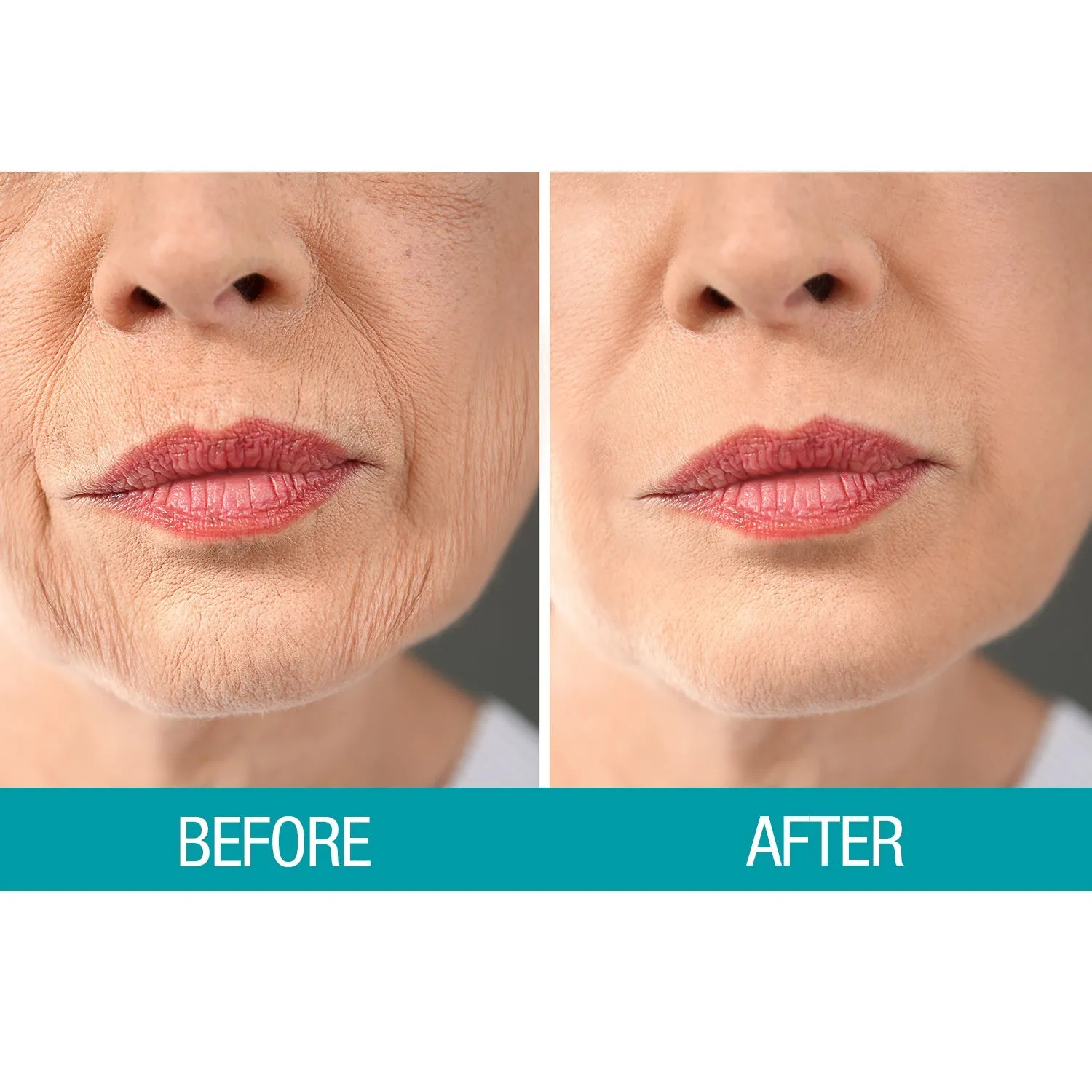 Dermactin Crepe Be Gone Firming Neck Cream 3 oz.