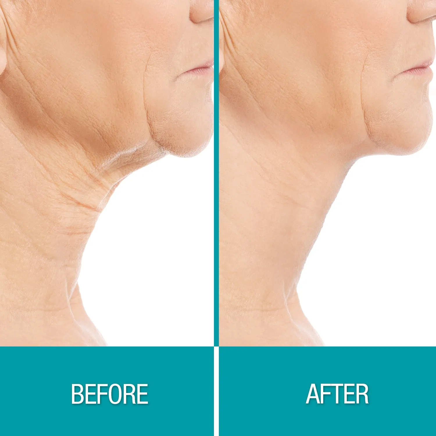 Dermactin Crepe Be Gone Firming Neck Cream 3 oz.