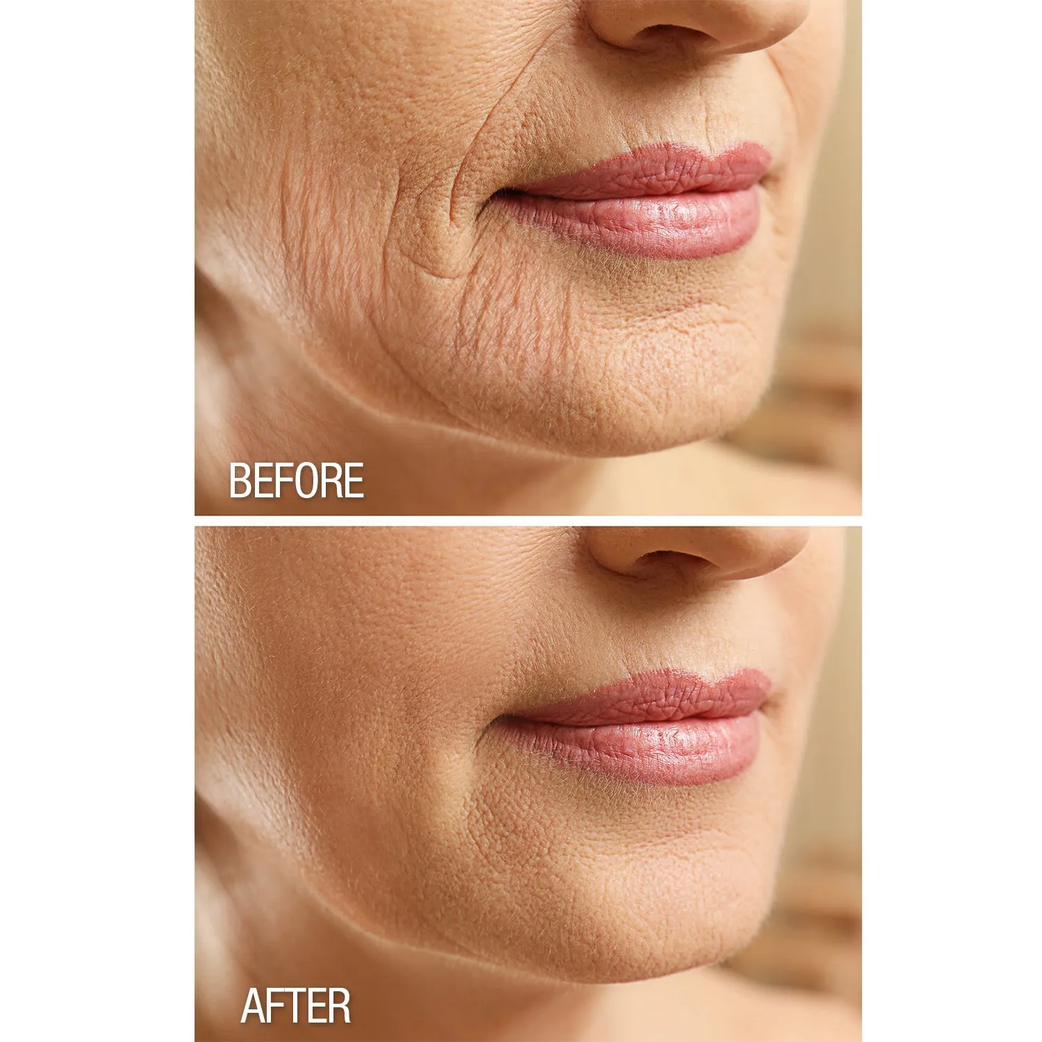 Dermactin Crepe Be Gone Firming Neck Cream 3 oz.