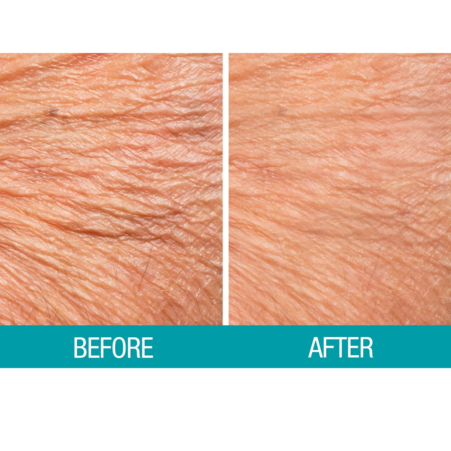 Dermactin Crepe Be Gone Firming Neck Cream 3 oz.