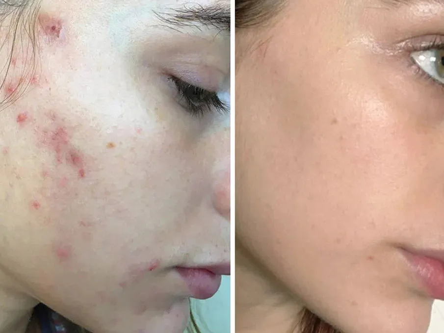 Express Facial