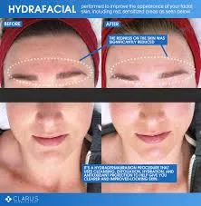 Express Facial