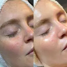 Express Facial