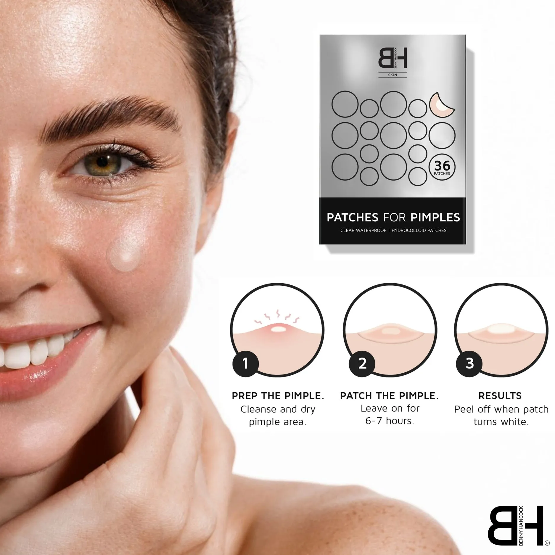 PATCHES FOR PIMPLES